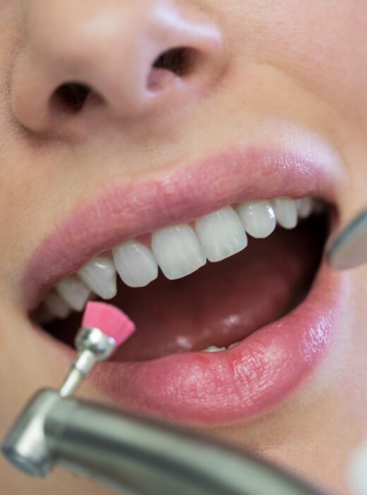 kieszonki dziąsłowe