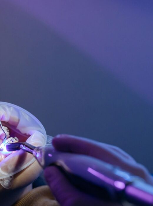 Czy warto zakładać aparat retencyjny po leczeniu ortodontycznym?