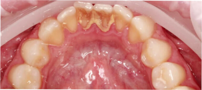 Higienizacja - przed