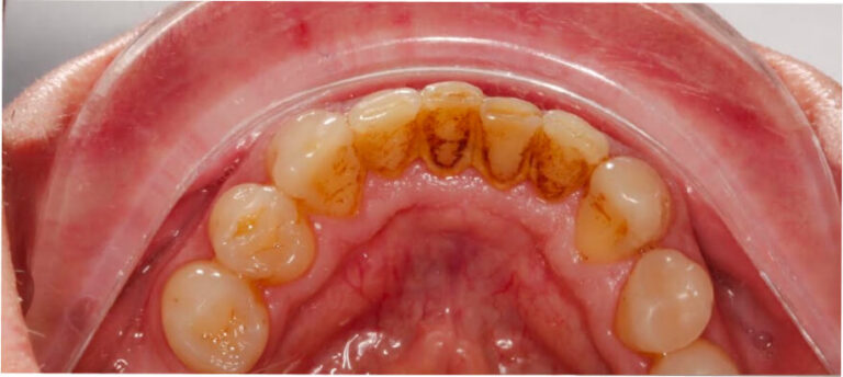 Higienizacja - przed