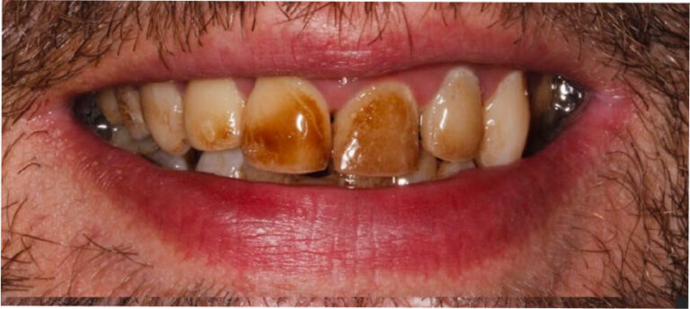 Higienizacja - przed