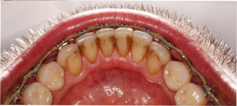 Higienizacja - przed