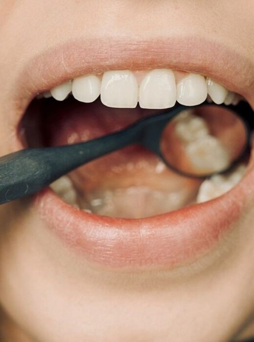 Krwawienie dziąseł