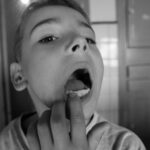 Kserostomia (suchość w ustach) – przyczyny, skutki dla zębów i jak to leczyć