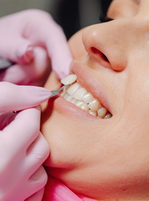 Licówki ceramiczne i kompozytowe warszawa