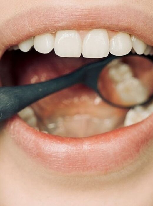 przebarwienia na zębach usuwanie warszawa