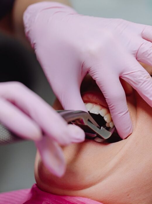 usuwanie zębów stałych warszawa